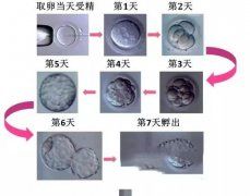 ʲô�������̥�ɹ��ʸ���' /></a></div>
		<div class=